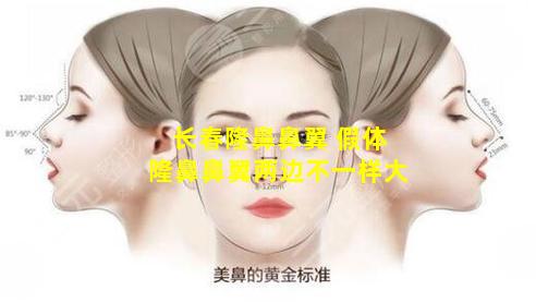 长春隆鼻鼻翼 假体隆鼻鼻翼两边不一样大